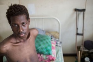 Tuberculosis